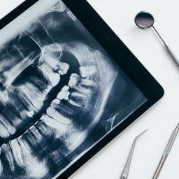 Tiêu xương hàm 3