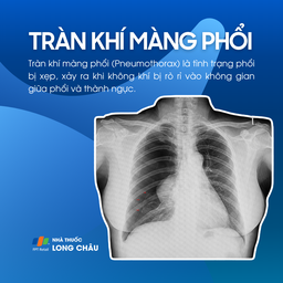 Tràn khí màng phổi 1