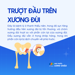 Trượt đầu trên xương đùi 1