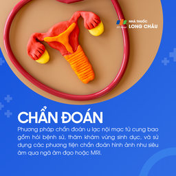 U lạc nội mạc tử cung 5