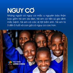 U nguyên bào thận 4