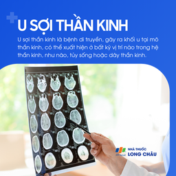U sợi thần kinh 1