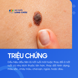 U tế bào hắc tố 2