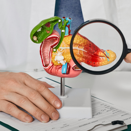  Ung thư đường mật 1