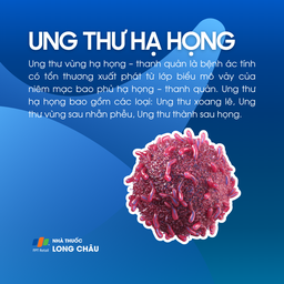 Ung thư hạ họng 1