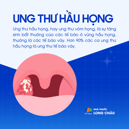 Ung thư hầu họng 1