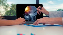 Ung thư não: Triệu chứng, nguyên nhân và cách điều trị 2