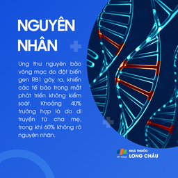 Ung thư nguyên bào võng mạc 3