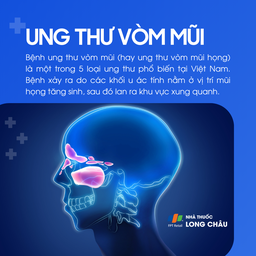 Ung thư vòm mũi 1
