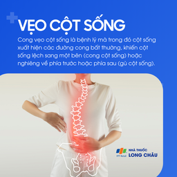 Vẹo cột sống 1