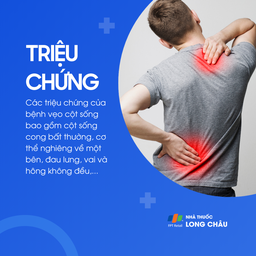 Vẹo cột sống 2