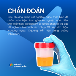 Viêm cầu thận mạn 5