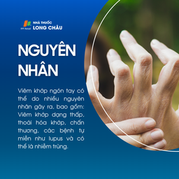 Viêm khớp ngón tay 3