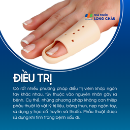 Viêm khớp ngón tay 6