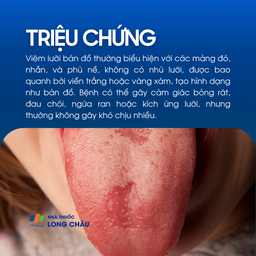 Viêm lưỡi bản đồ 2