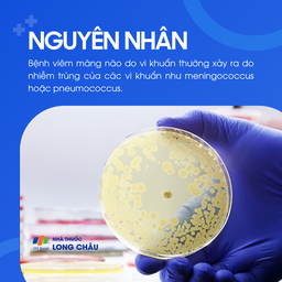 Viêm màng não do vi khuẩn 3