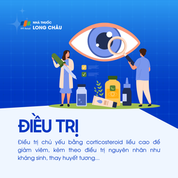 Viêm thị thần kinh 6