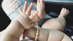 Vòng thắt chi bẩm sinh 2