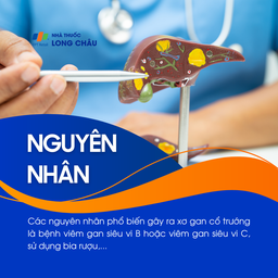 Xơ gan cổ trướng 3