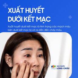 Xuất huyết dưới kết mạc 1
