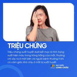 Xuất huyết dưới kết mạc 2