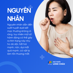 Xuất huyết dưới kết mạc 3