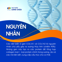 Xương thủy tinh 3