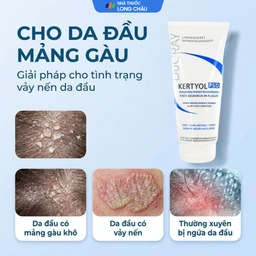 Dầu gội Ducray Kertyol P.S.O Shampoo làm sạch tóc, loại bỏ gàu dạng mảng và vảy nến (125ml) 4