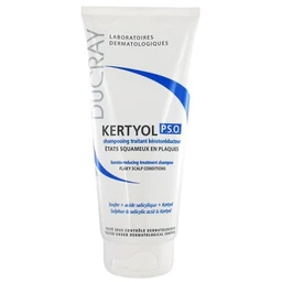 Dầu gội Ducray Kertyol P.S.O Shampoo làm sạch tóc, loại bỏ gàu dạng mảng và vảy nến (125ml) 1