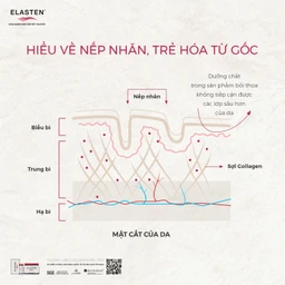 Nước uống bổ sung Collagen-Peptide, giúp giảm lão hóa da, tăng độ đàn hồi và giữ ẩm cho da, giúp da sáng mịn Elasten (28+2 ống x 25ml) 4