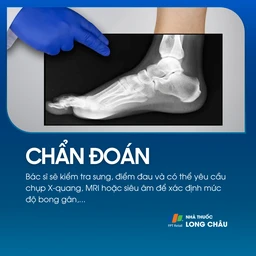 Bác sĩ kiểm tra, có thể chỉ định X-quang, MRI, siêu âm