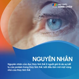 Đục thủy tinh thể 3