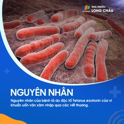 Vết thương bị nhiễm trùng Clostridium tetani, vi khuẩn gây ra bệnh uốn ván, thường xảy ra ở những vùng không sạch sẽ