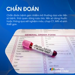Chẩn đoán gan nhiễm mỡ - Quy trình kiểm tra và xác định tình trạng gan nhiễm mỡ