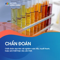Chẩn đoán hội chứng thận hư - Quy trình kiểm tra và xác định bệnh lý thận hư