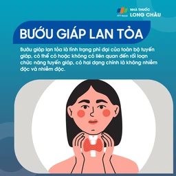 Bướu giáp lan tỏa 1