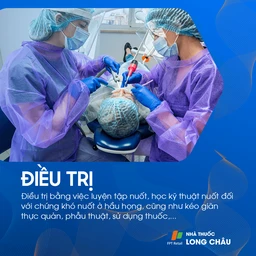 Chứng khó nuốt 6