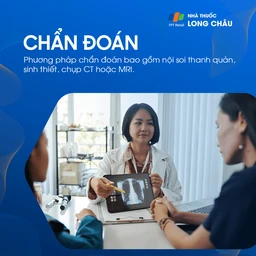 ung thư thanh quản 5