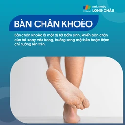 Bàn Chân Khoèo 1