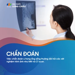 U Trong Ống Sống 5