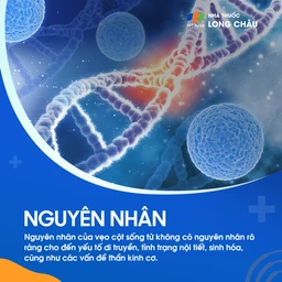 Vẹo Cột Sống Tự Phát 3