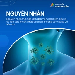 Viêm Khớp Liên Cầu 3