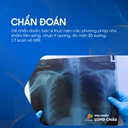 Xẹp Đốt Sống 5