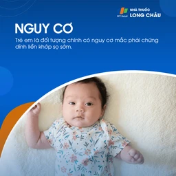 Chứng dính liền khớp sọ sớm 4