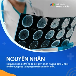 Chứng mất ngôn ngữ 3