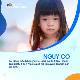 Cơn động kinh vắng ý thức 4