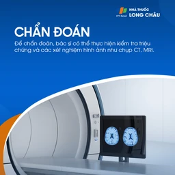 Đau đầu mạn tính 5