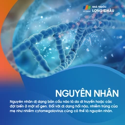 Dị dạng bán cầu não 3