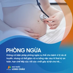 Dị dạng bán cầu não 7
