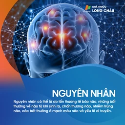 Động kinh thùy thái dương 4